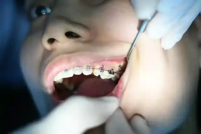 NHS orthodontic treatment